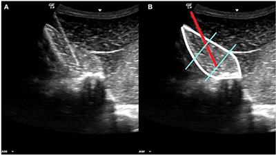 Electromyography of the Multifidus Muscle in Horses Trotting During Therapeutic Exercises